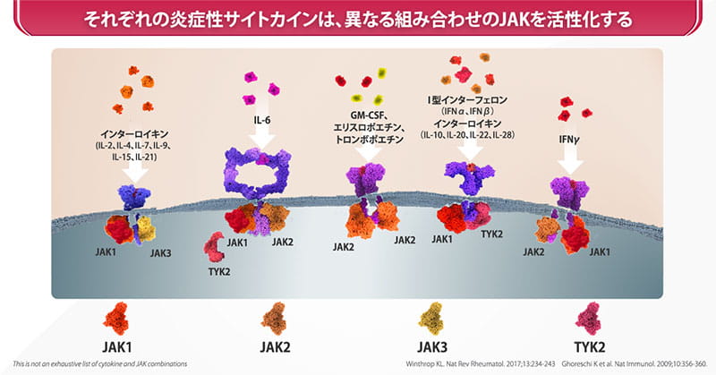炎症性サイトカインは、異なる組み合わせのJAKを活性化