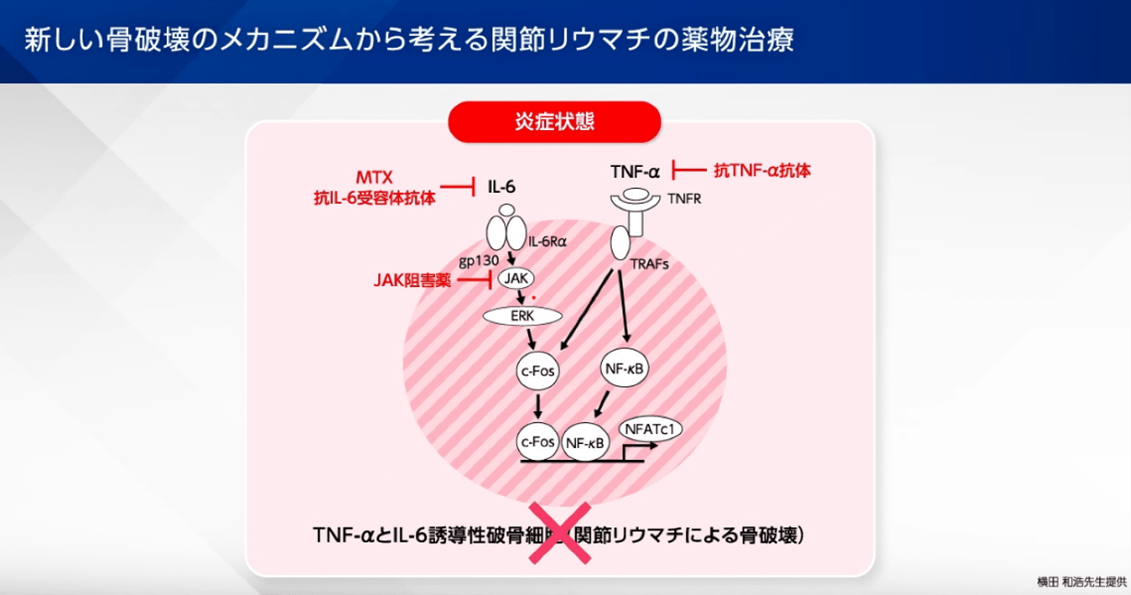 新しい骨破壊のメカニズムから考える関節リウマチの薬物治療
