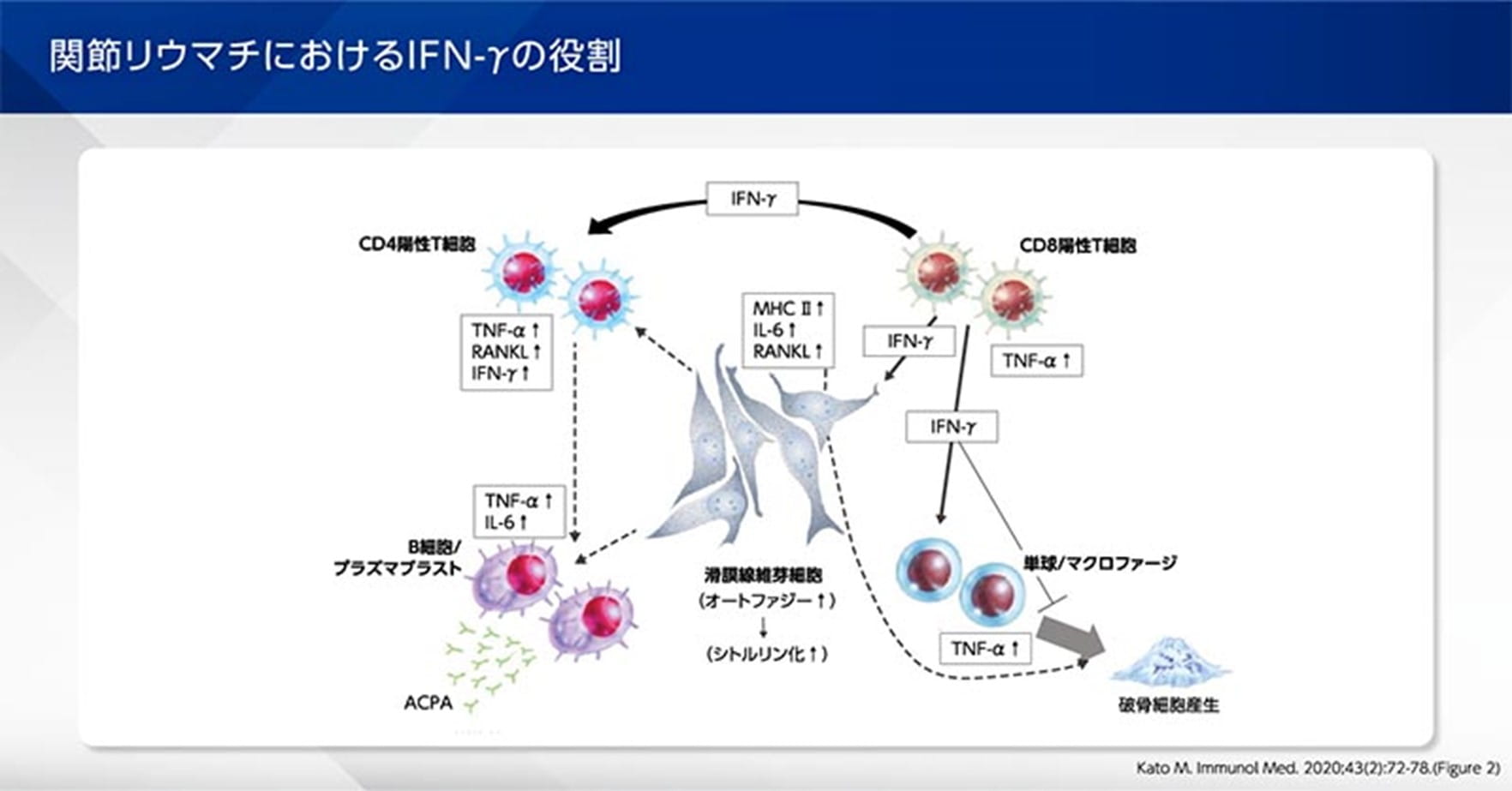 関節リウマチにおけるINF-γの役割