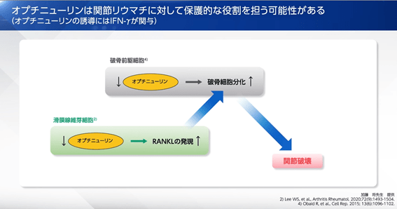 オプチニューリンは関節リウマチに対して保護的な役割を担う可能性がある