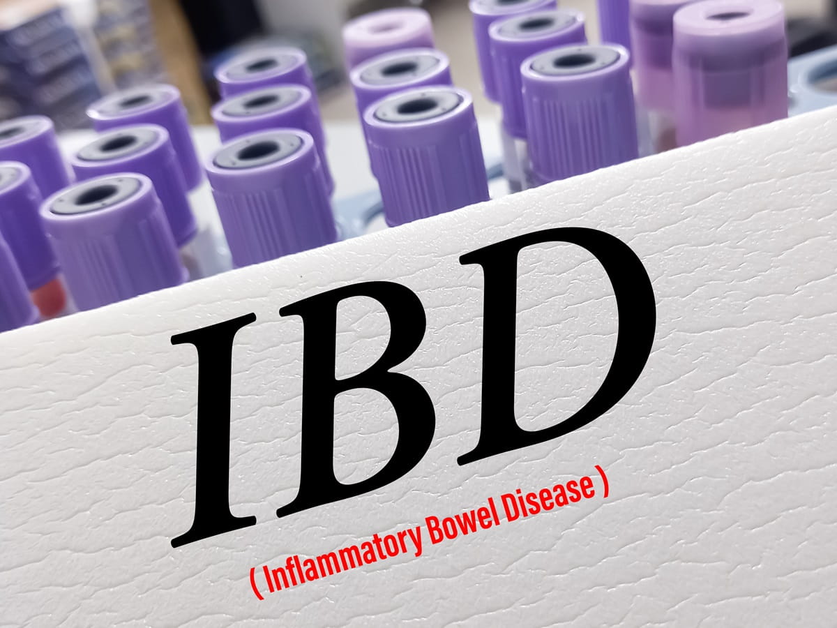 遺伝的因子よりも環境因子がIBD診断時年齢に影響を及ぼす